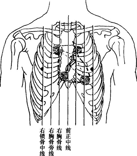 胸部的位置